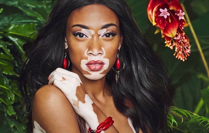 In Desigual campaign