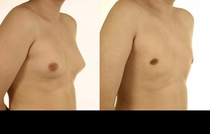 Men should not only stop sweating, they should also take care of their chest