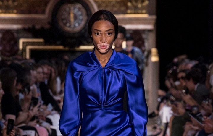 Winnie Harlow