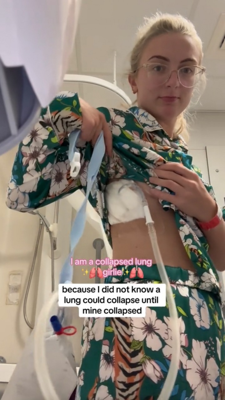 Olivia Smith experienced a lung collapse at the age of 21
