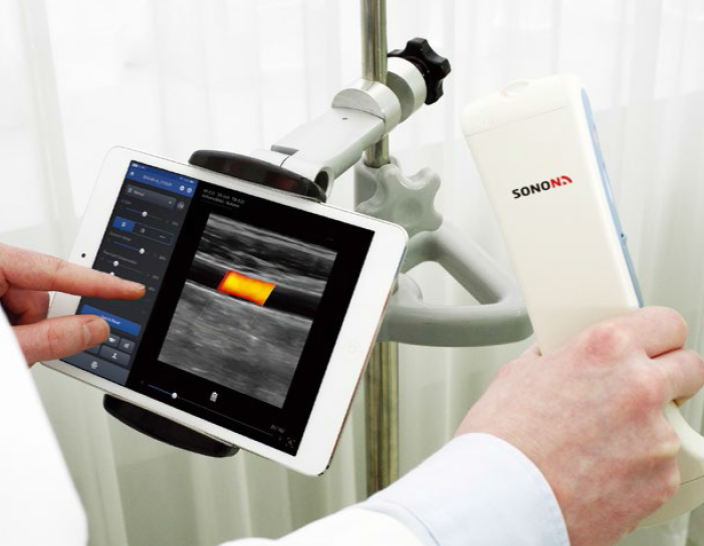 Bezdrátová ultrazvuková sonda HEALCERION SONON 300L